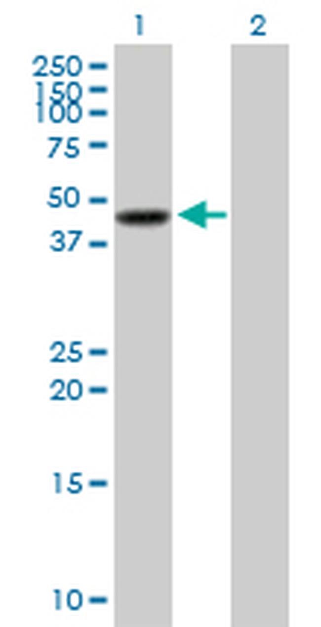 SERPINB3 Antibody in Western Blot (WB)