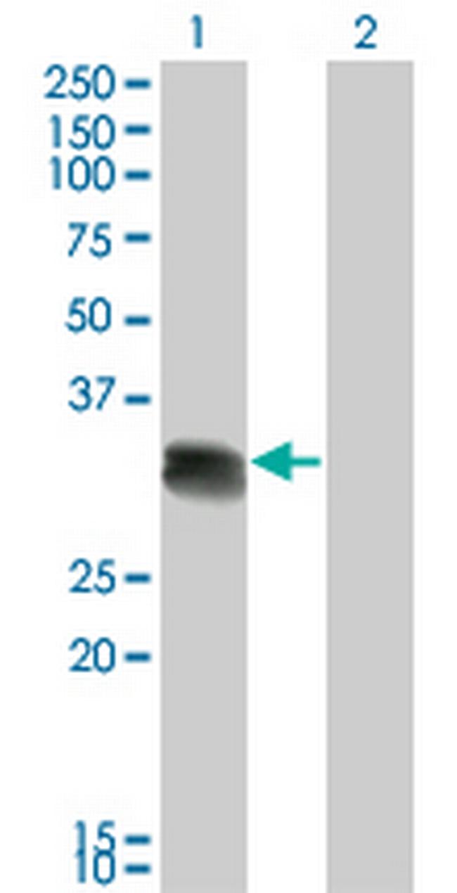 SCML1 Antibody in Western Blot (WB)