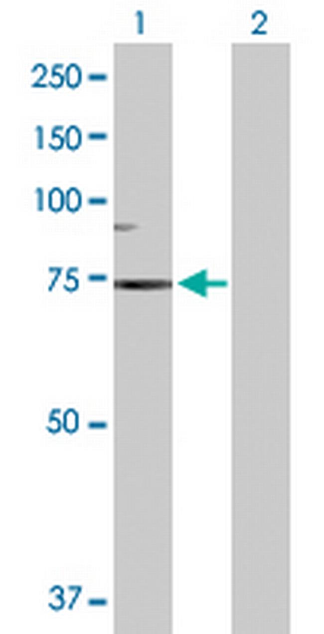 SCNN1B Antibody in Western Blot (WB)