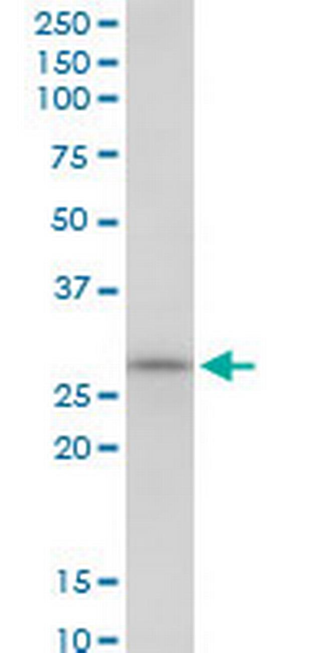 SCO1 Antibody in Western Blot (WB)