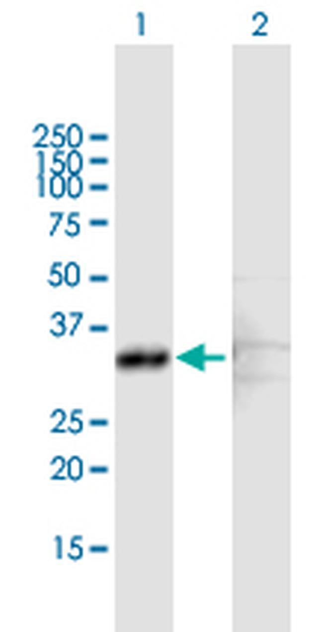 SCP2 Antibody in Western Blot (WB)