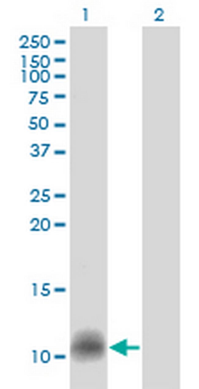 CCL14 Antibody in Western Blot (WB)
