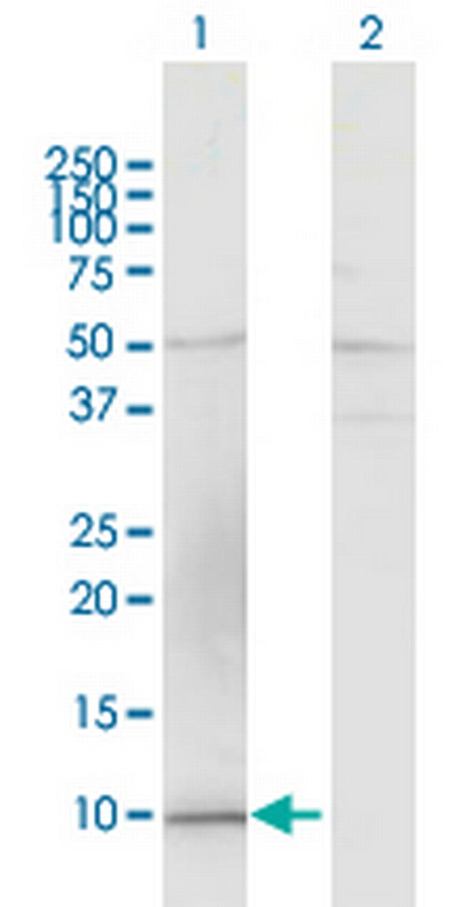 CCL15 Antibody in Western Blot (WB)
