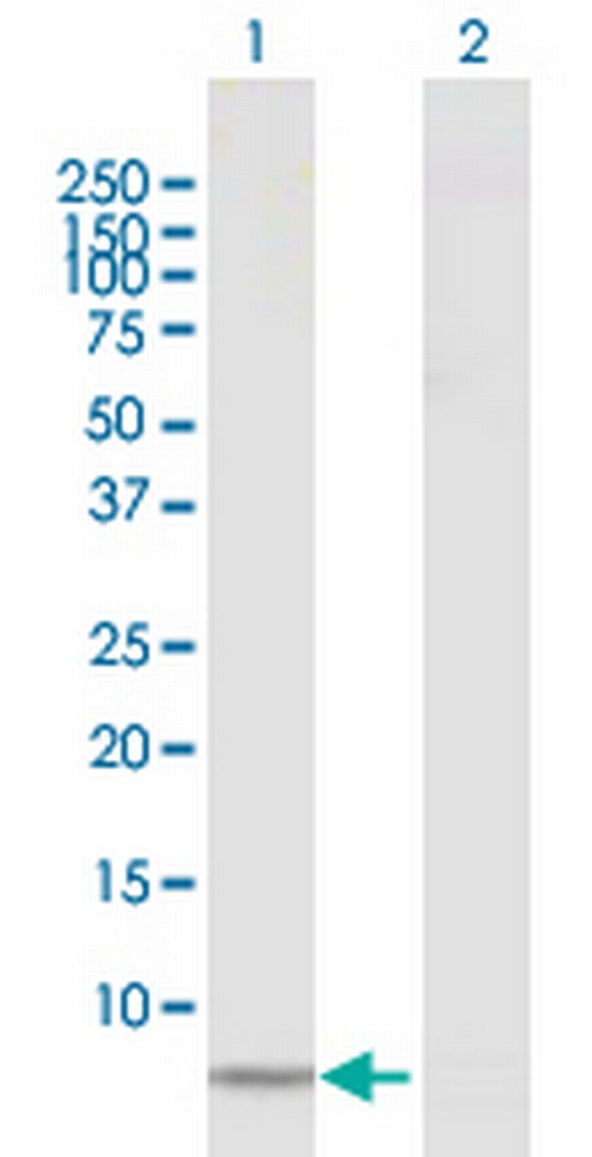 CCL18 Antibody in Western Blot (WB)