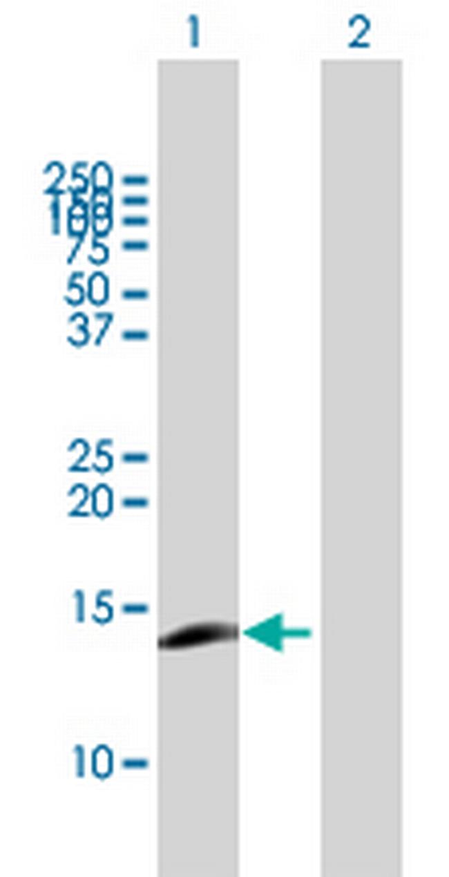 CCL23 Antibody in Western Blot (WB)