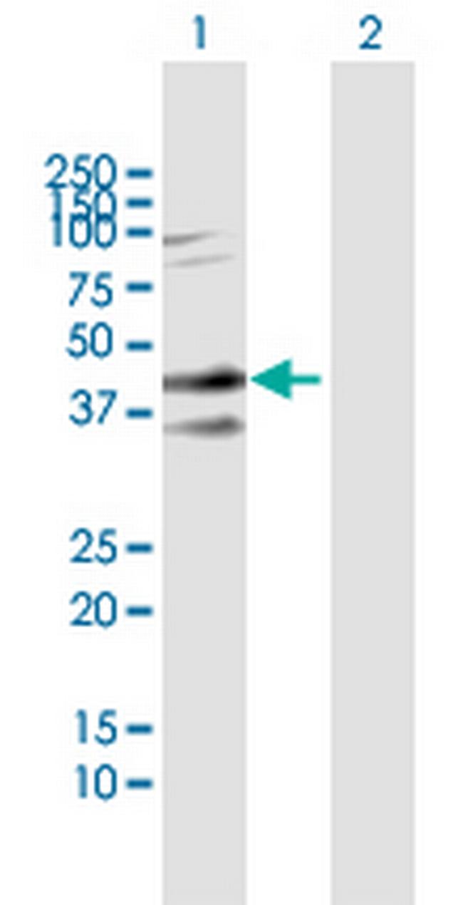 SDC2 Antibody in Western Blot (WB)