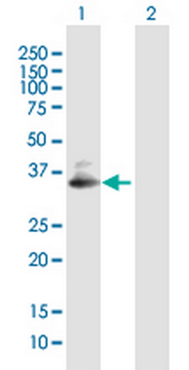 SDC4 Antibody in Western Blot (WB)