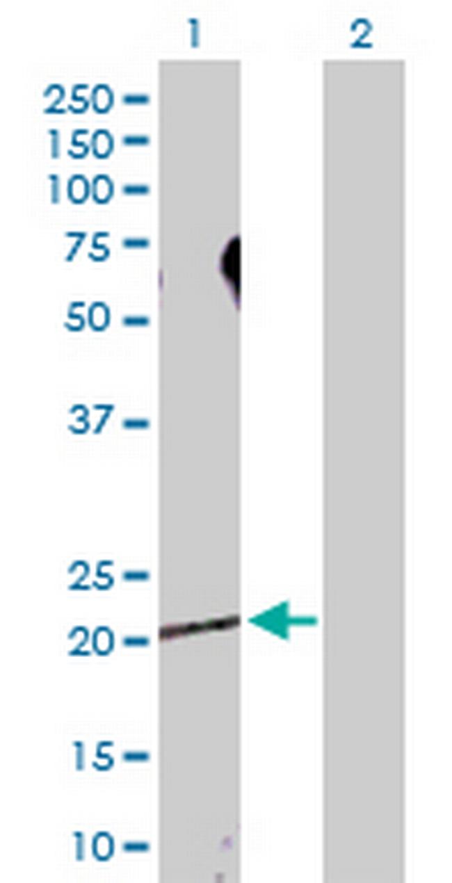 SDCBP Antibody in Western Blot (WB)