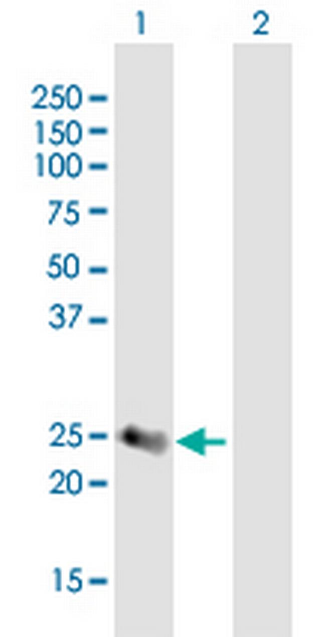 SECTM1 Antibody in Western Blot (WB)