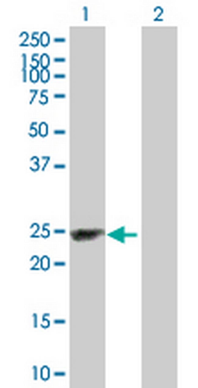 SECTM1 Antibody in Western Blot (WB)