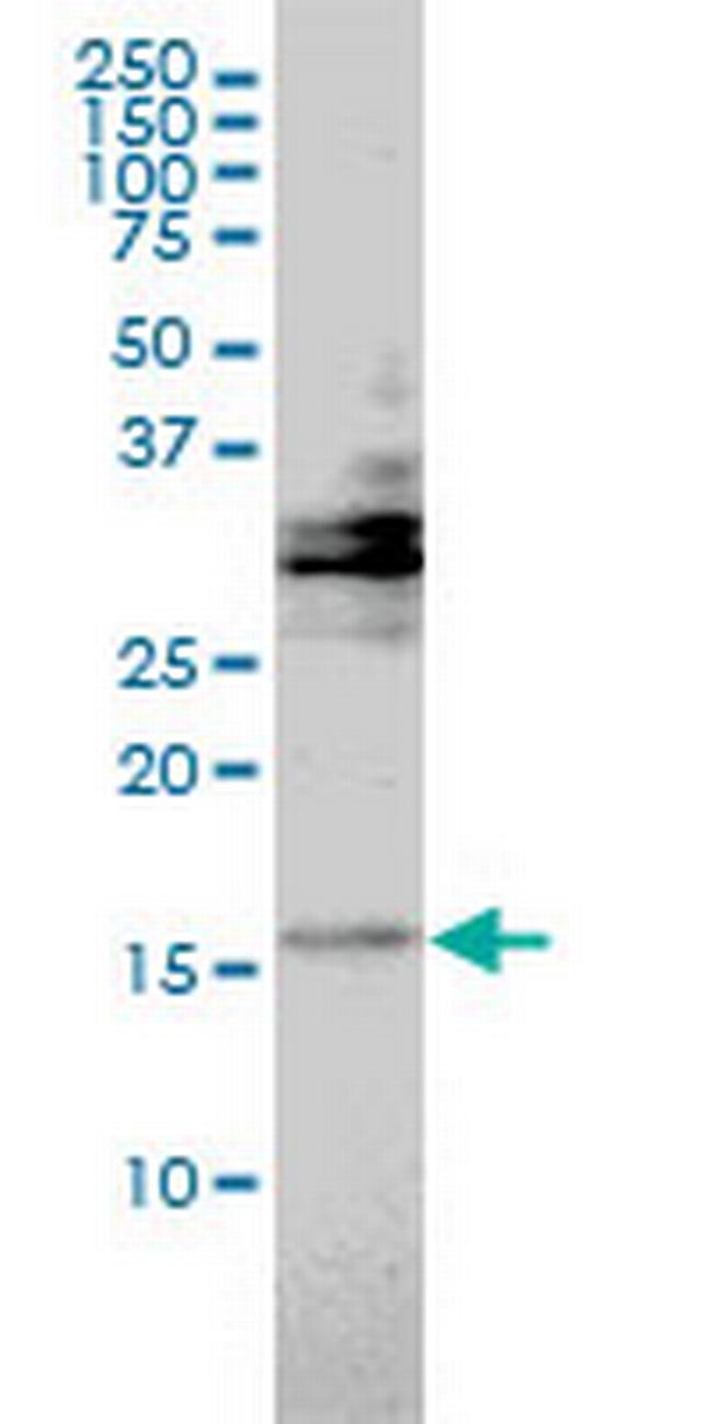 TRAPPC2 Antibody in Western Blot (WB)