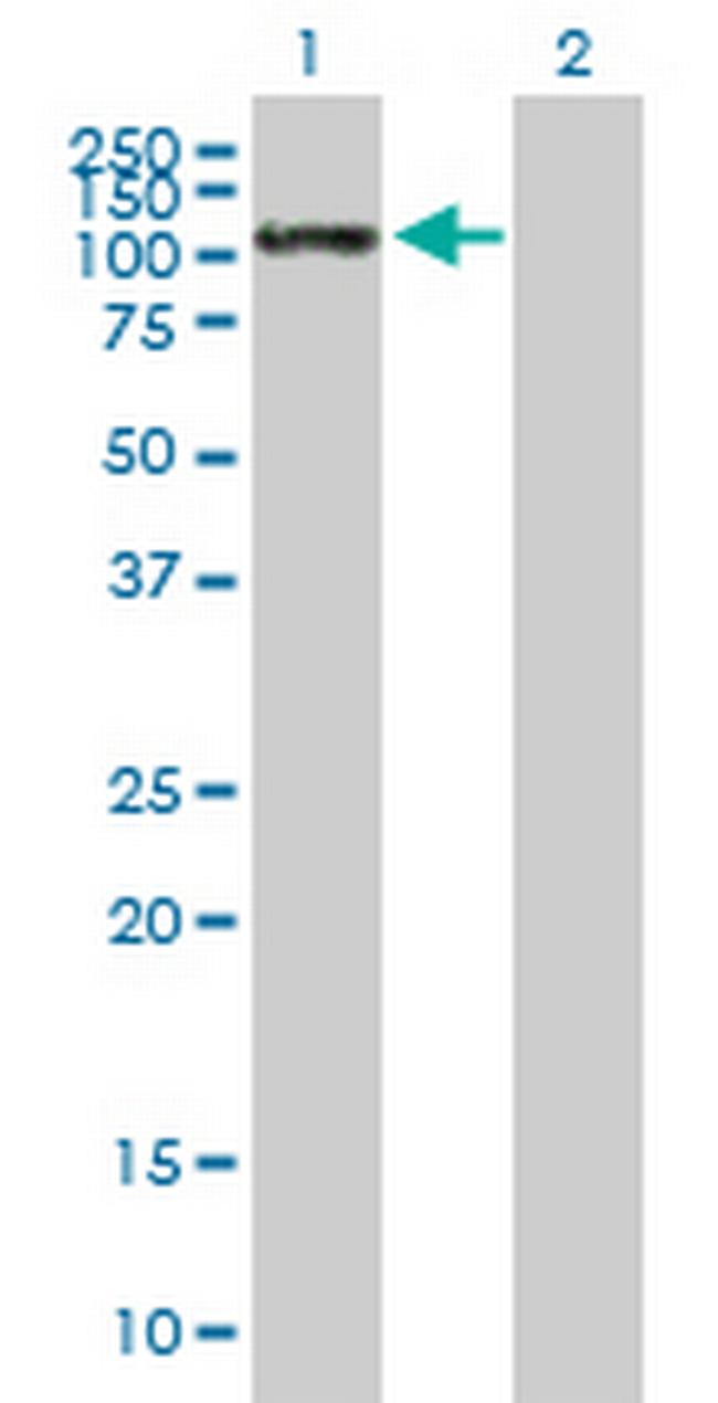 SELE Antibody in Western Blot (WB)
