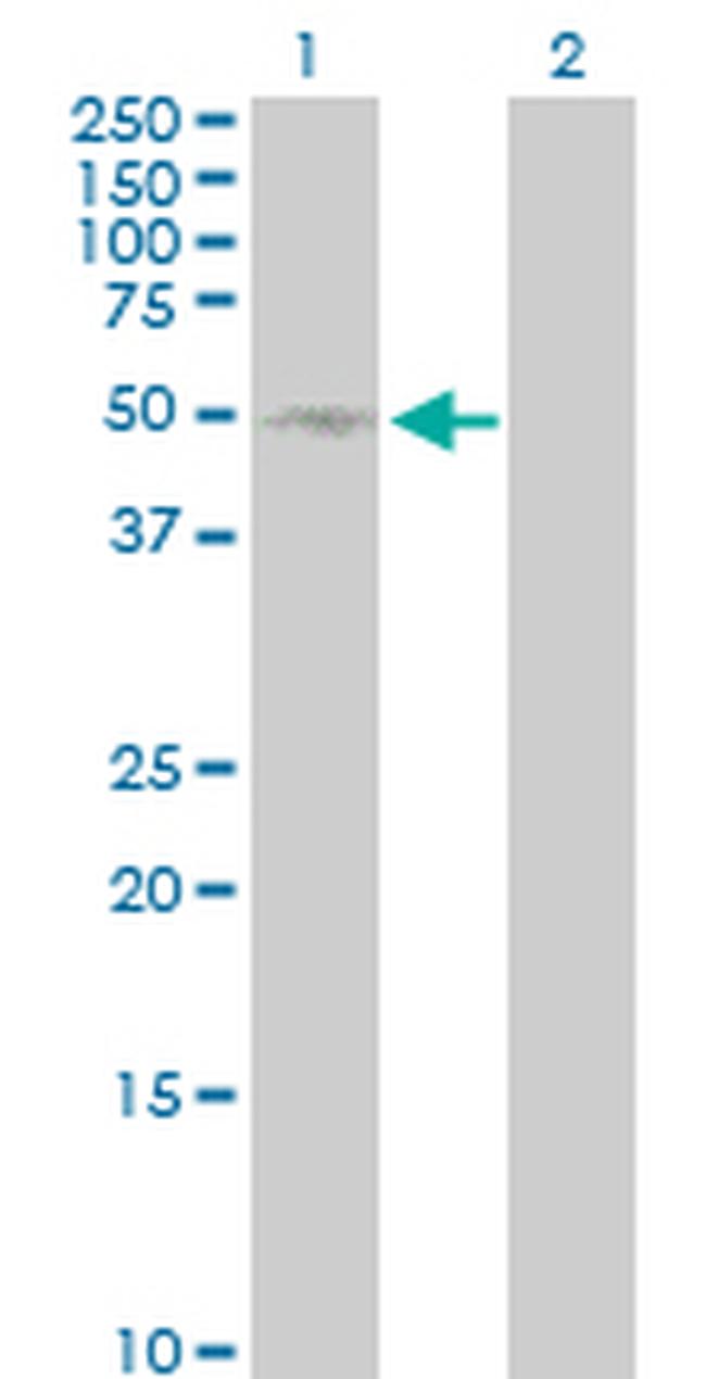 SELL Antibody in Western Blot (WB)