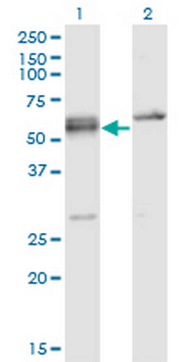 SFRS6 Antibody in Western Blot (WB)