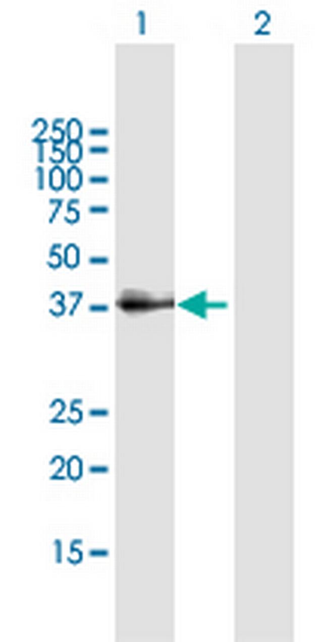 SFTPD Antibody in Western Blot (WB)