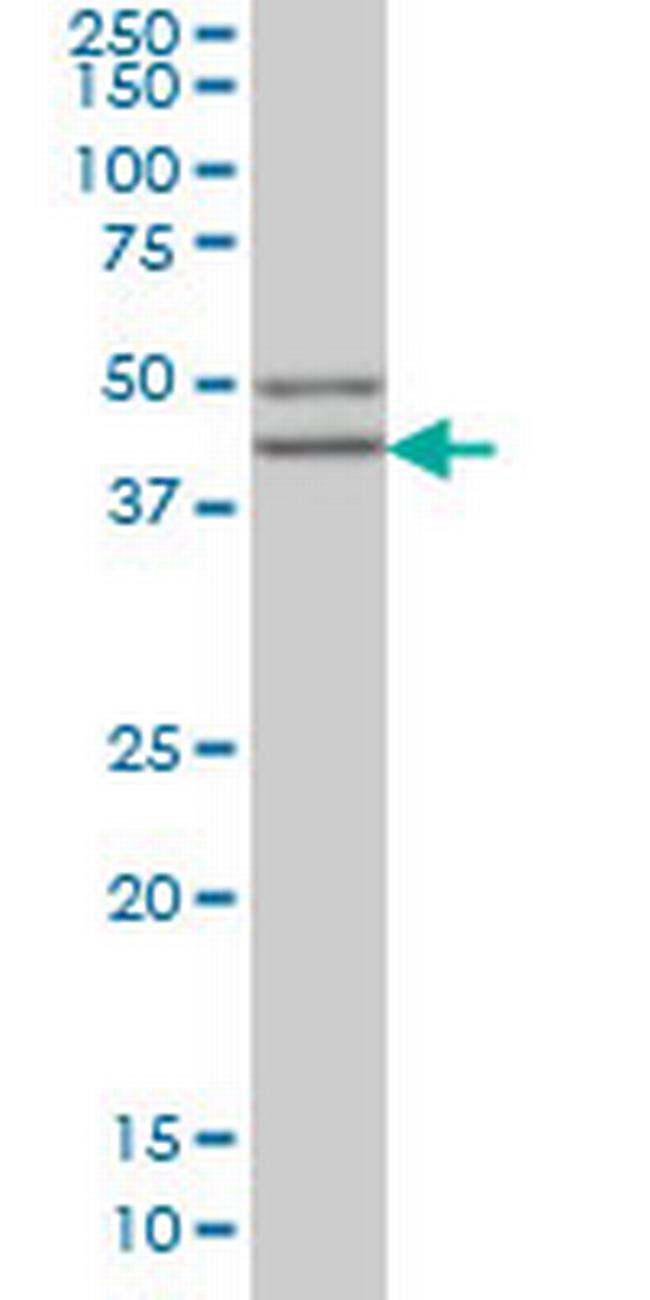 SGCB Antibody in Western Blot (WB)