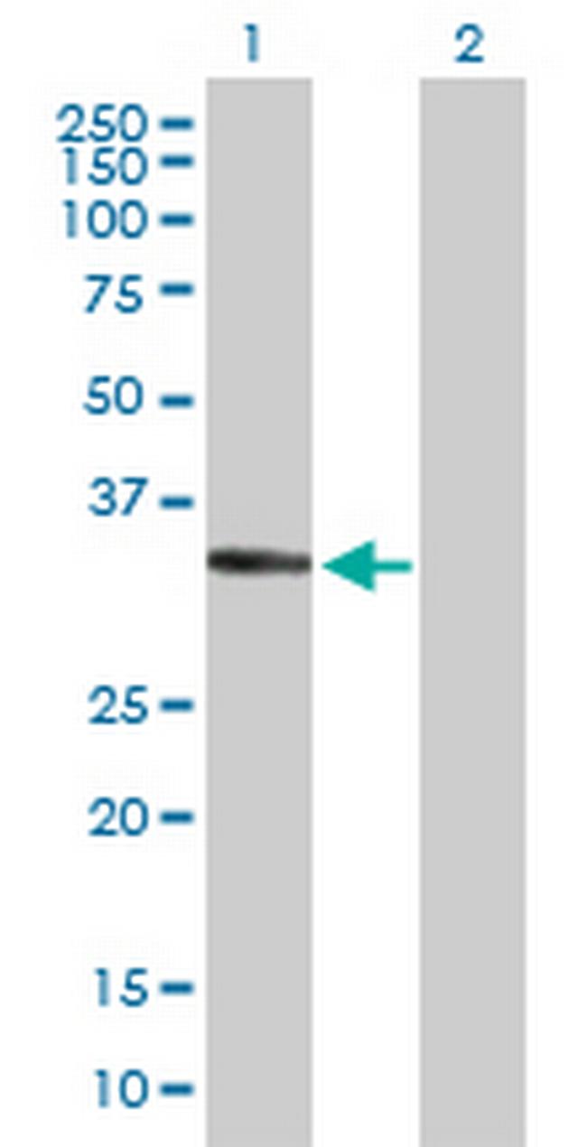 SGCD Antibody in Western Blot (WB)