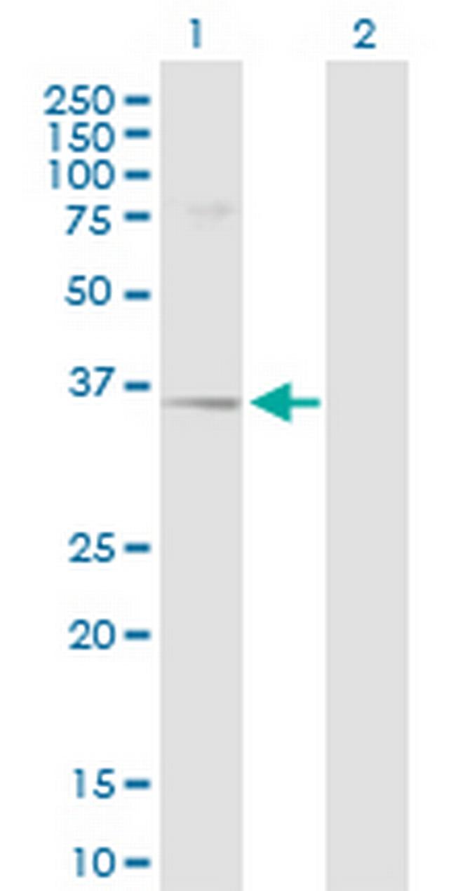 SGCD Antibody in Western Blot (WB)