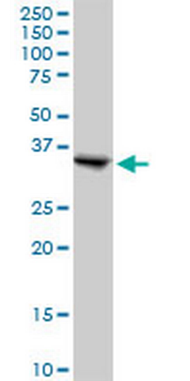 SGTA Antibody in Western Blot (WB)