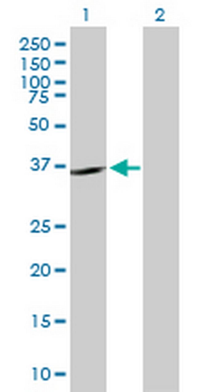 SHOX2 Antibody in Western Blot (WB)