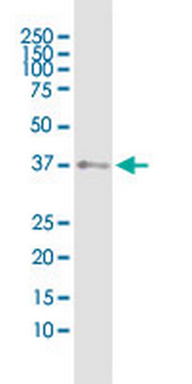 SHOX2 Antibody in Western Blot (WB)