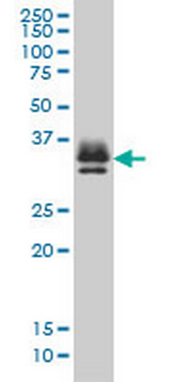 ST3GAL2 Antibody in Western Blot (WB)