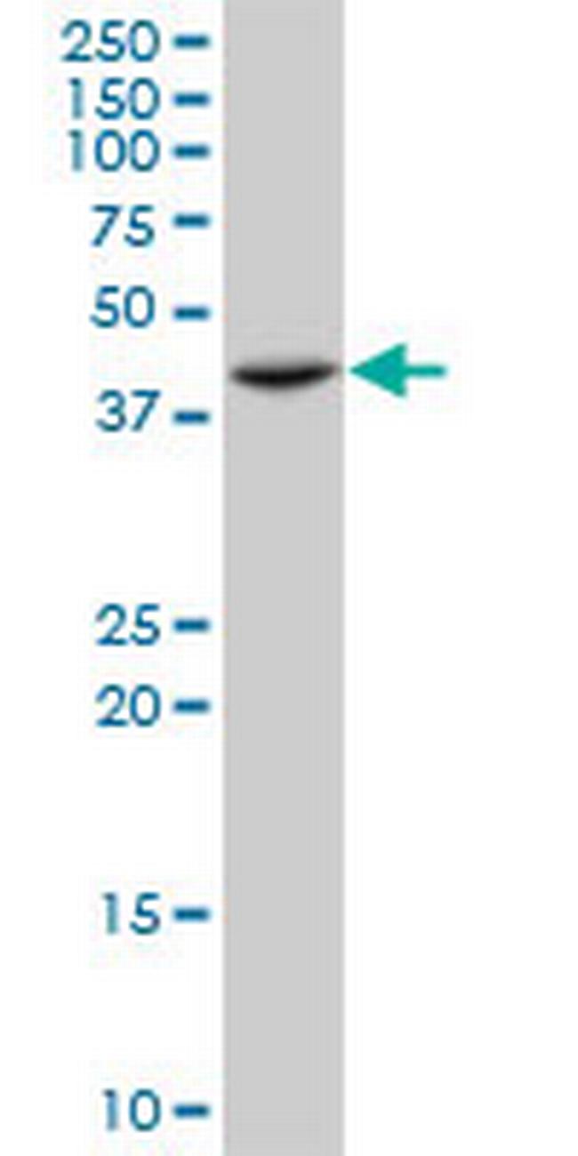 ST3GAL4 Antibody in Western Blot (WB)