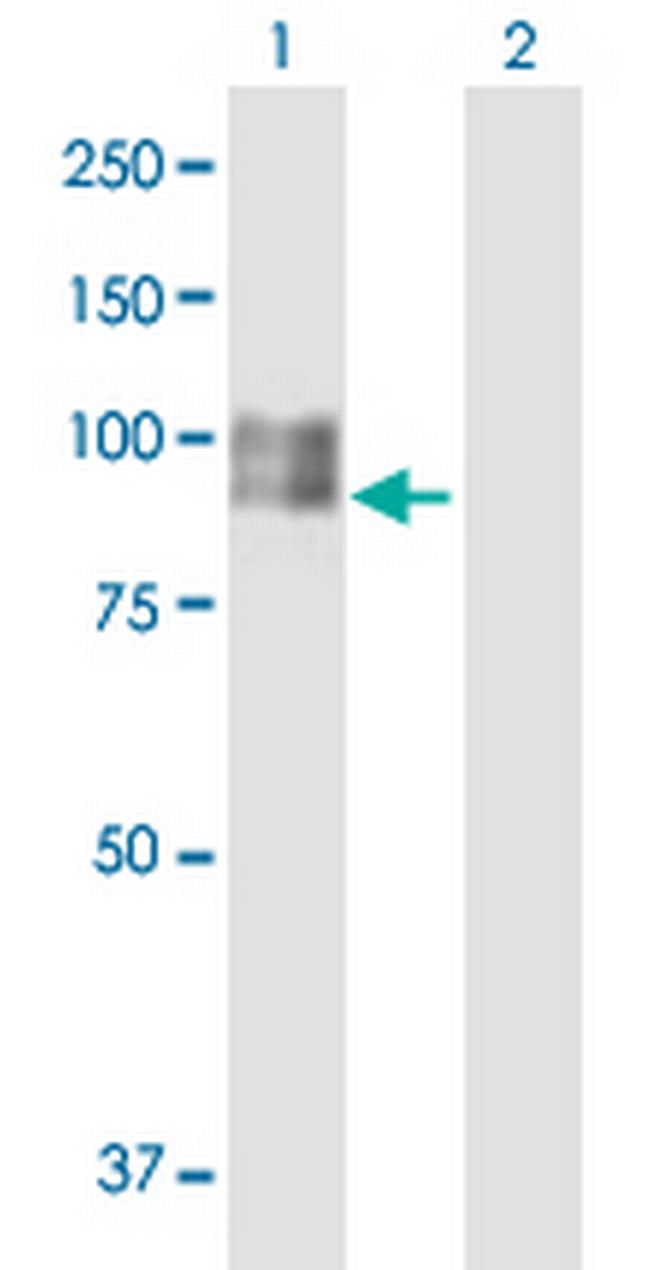 SILV Antibody in Western Blot (WB)