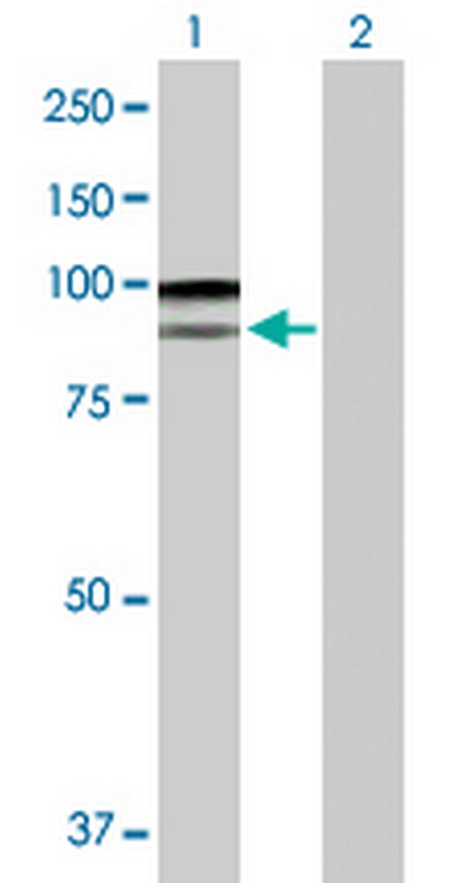 SILV Antibody in Western Blot (WB)