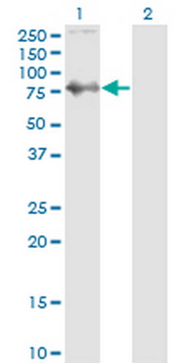 SKIL Antibody in Western Blot (WB)