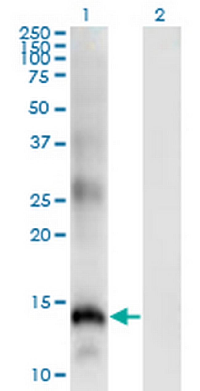 SLPI Antibody in Western Blot (WB)