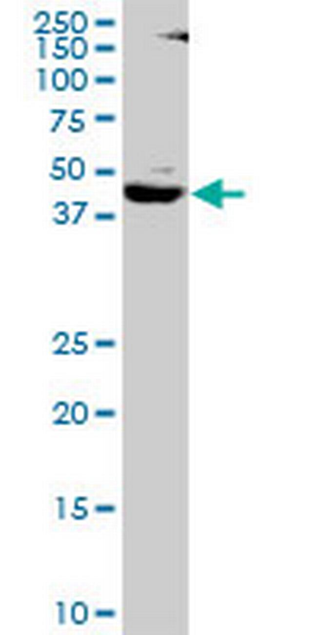 SMARCB1 Antibody in Western Blot (WB)