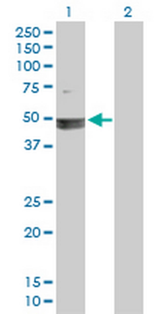 SMARCB1 Antibody in Western Blot (WB)