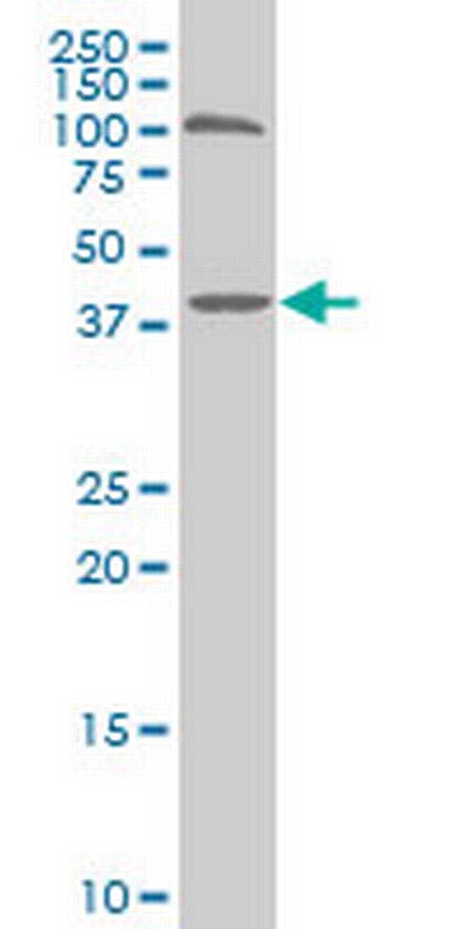 SMARCB1 Antibody in Western Blot (WB)