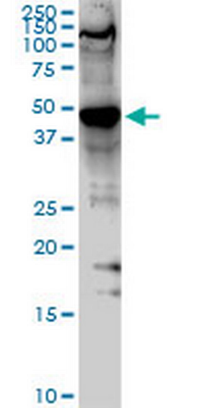 SMARCB1 Antibody in Western Blot (WB)