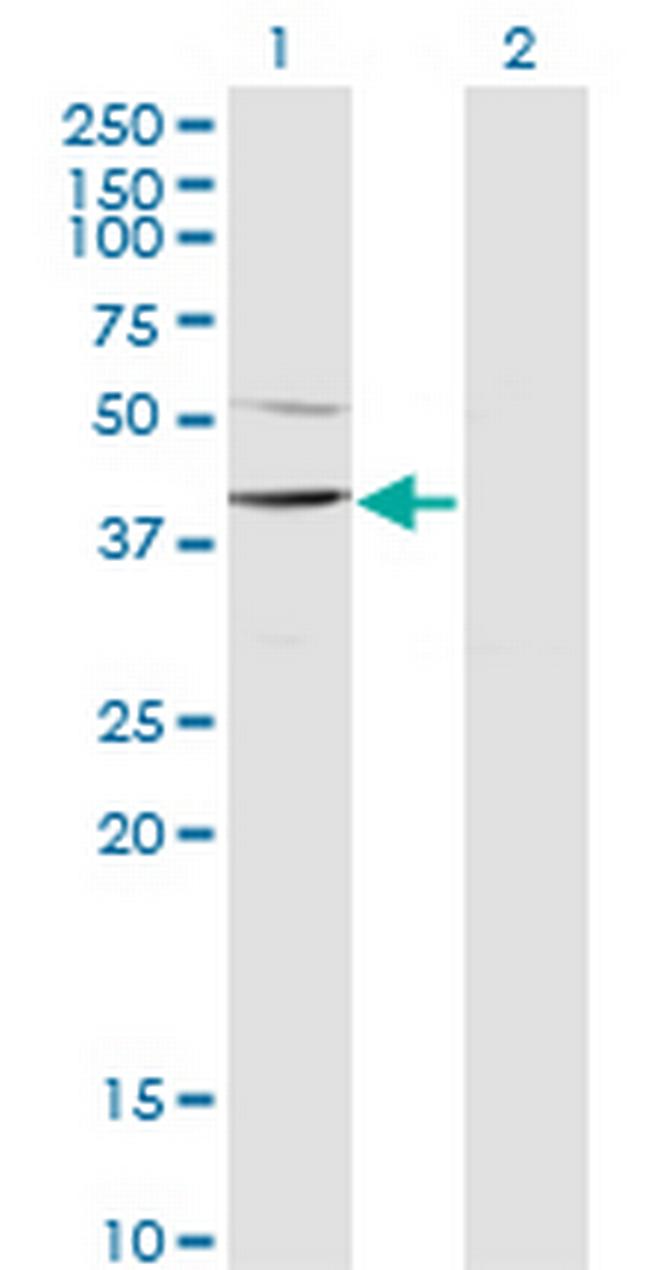 SMARCB1 Antibody in Western Blot (WB)