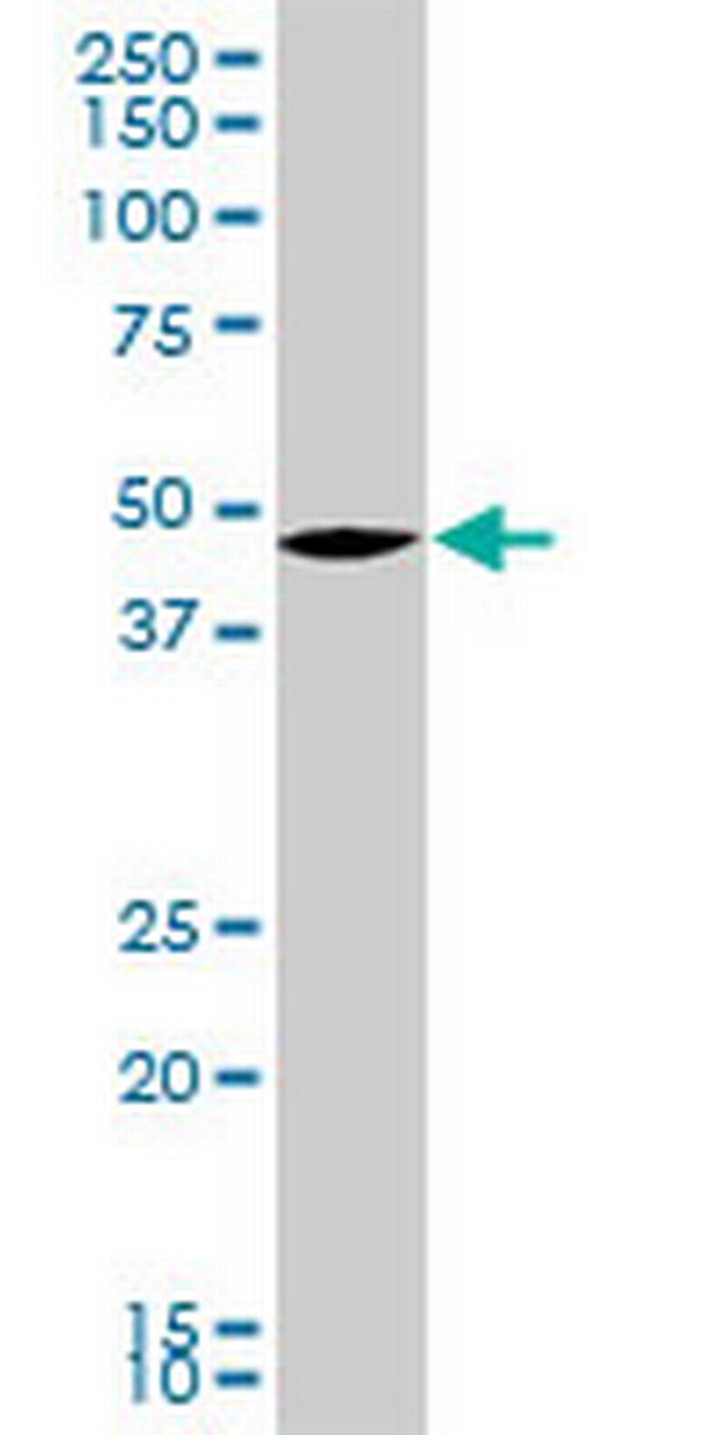 SMARCB1 Antibody in Western Blot (WB)