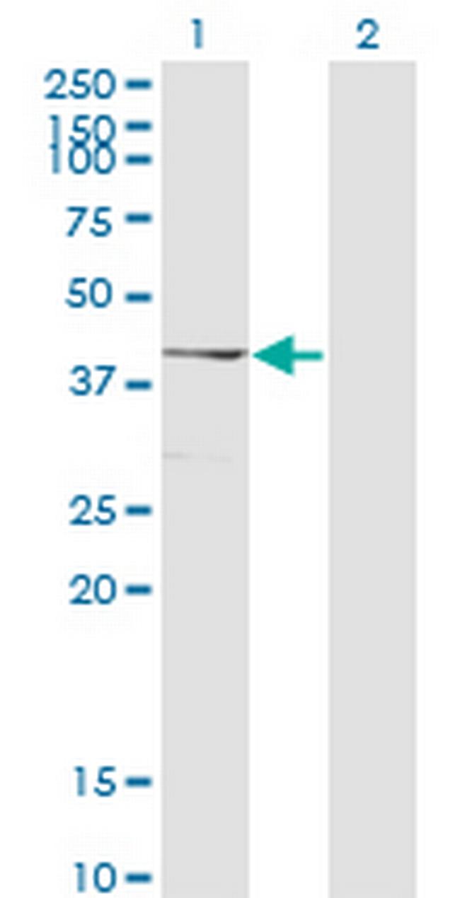 SMARCB1 Antibody in Western Blot (WB)