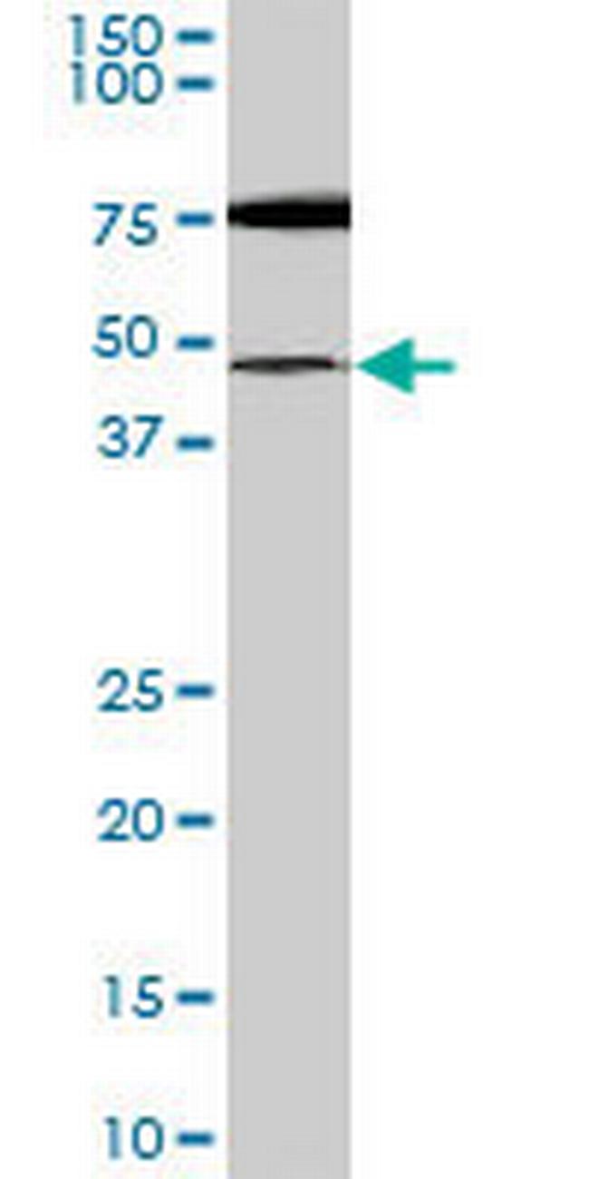 SMARCB1 Antibody in Western Blot (WB)