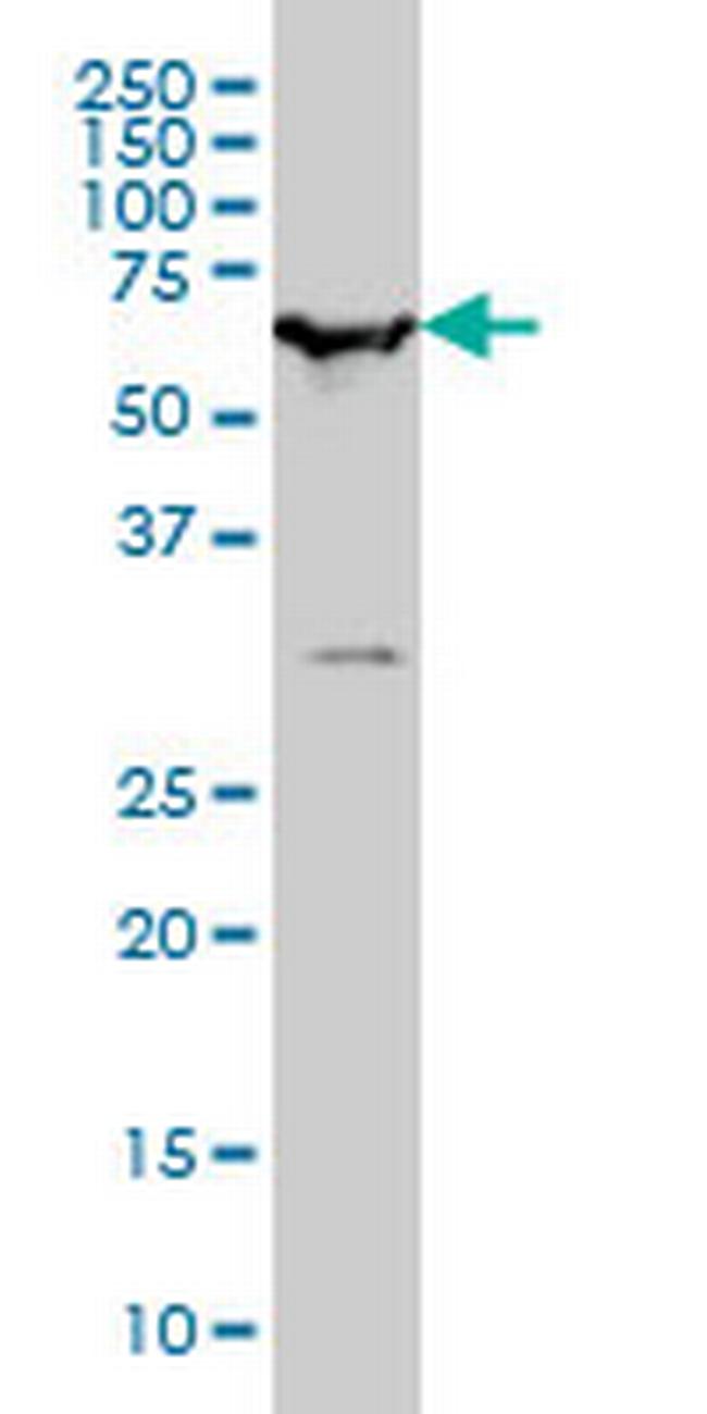 SMARCD2 Antibody in Western Blot (WB)