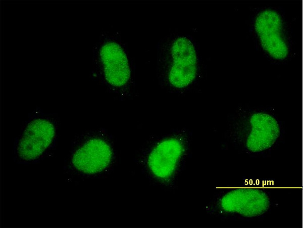 SMARCD2 Antibody in Immunocytochemistry (ICC/IF)
