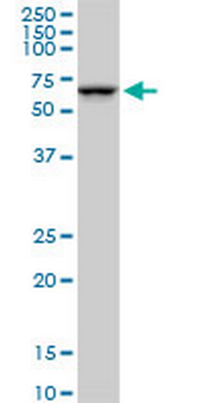 SMARCD2 Antibody in Western Blot (WB)