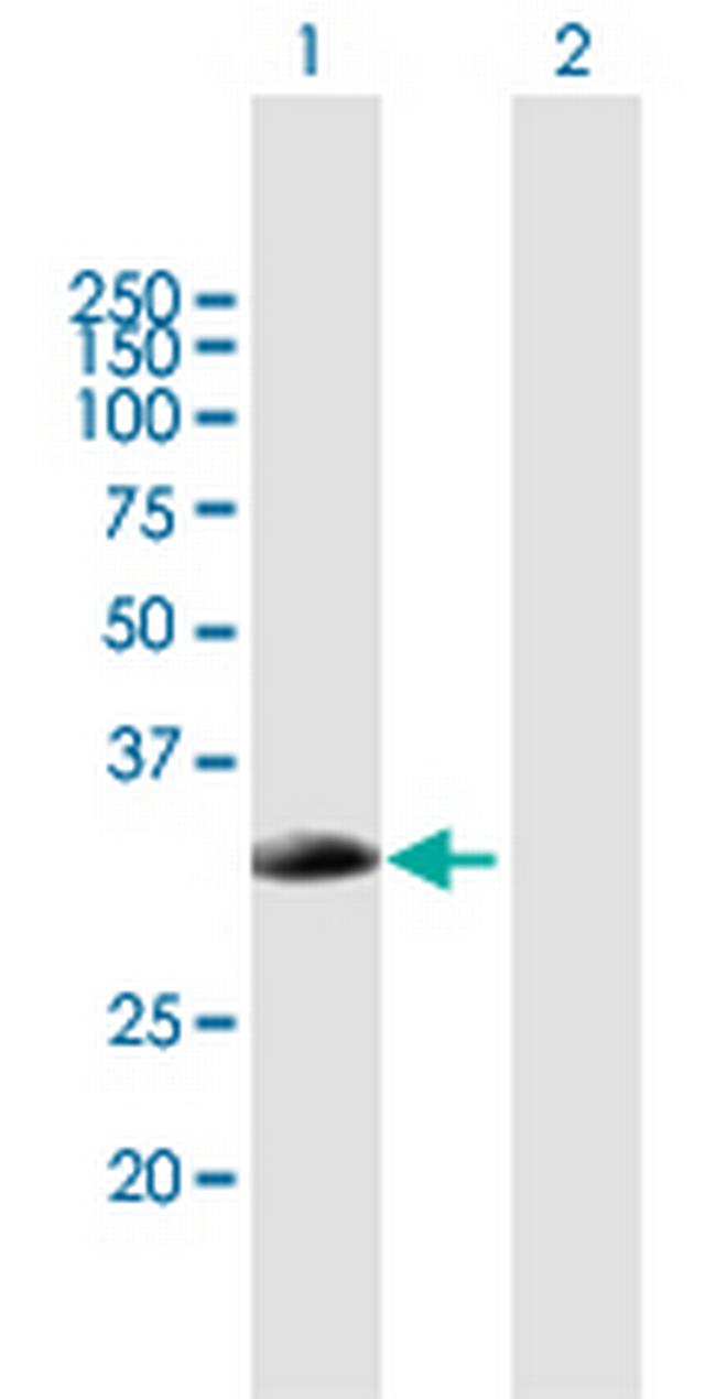 SMN2 Antibody in Western Blot (WB)