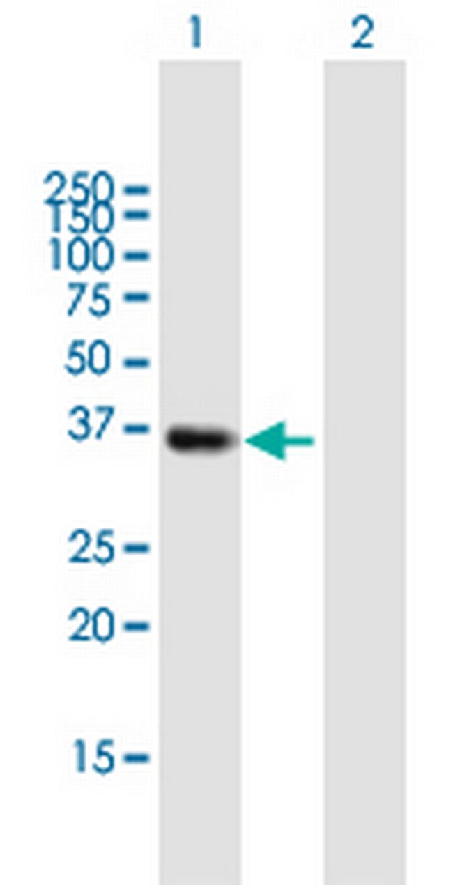 SMN2 Antibody in Western Blot (WB)