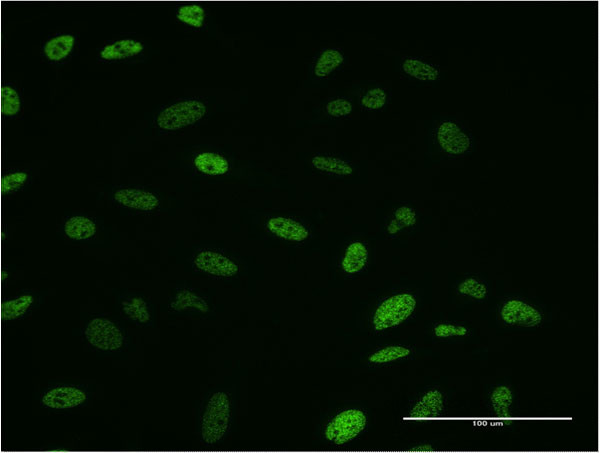 SMN2 Antibody in Immunocytochemistry (ICC/IF)