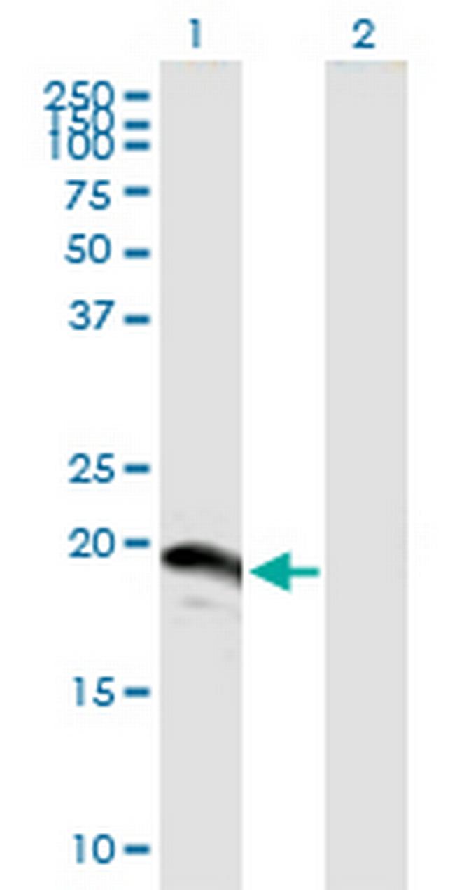 SUMO3 Antibody in Western Blot (WB)