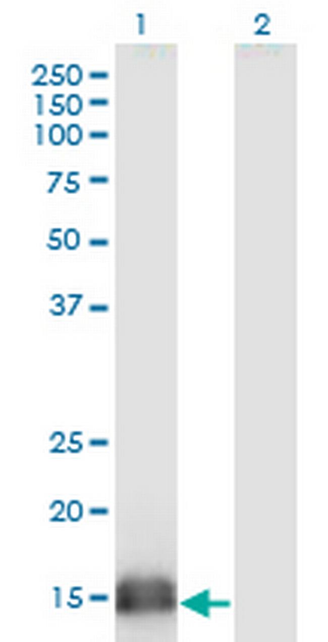 SUMO2 Antibody in Western Blot (WB)