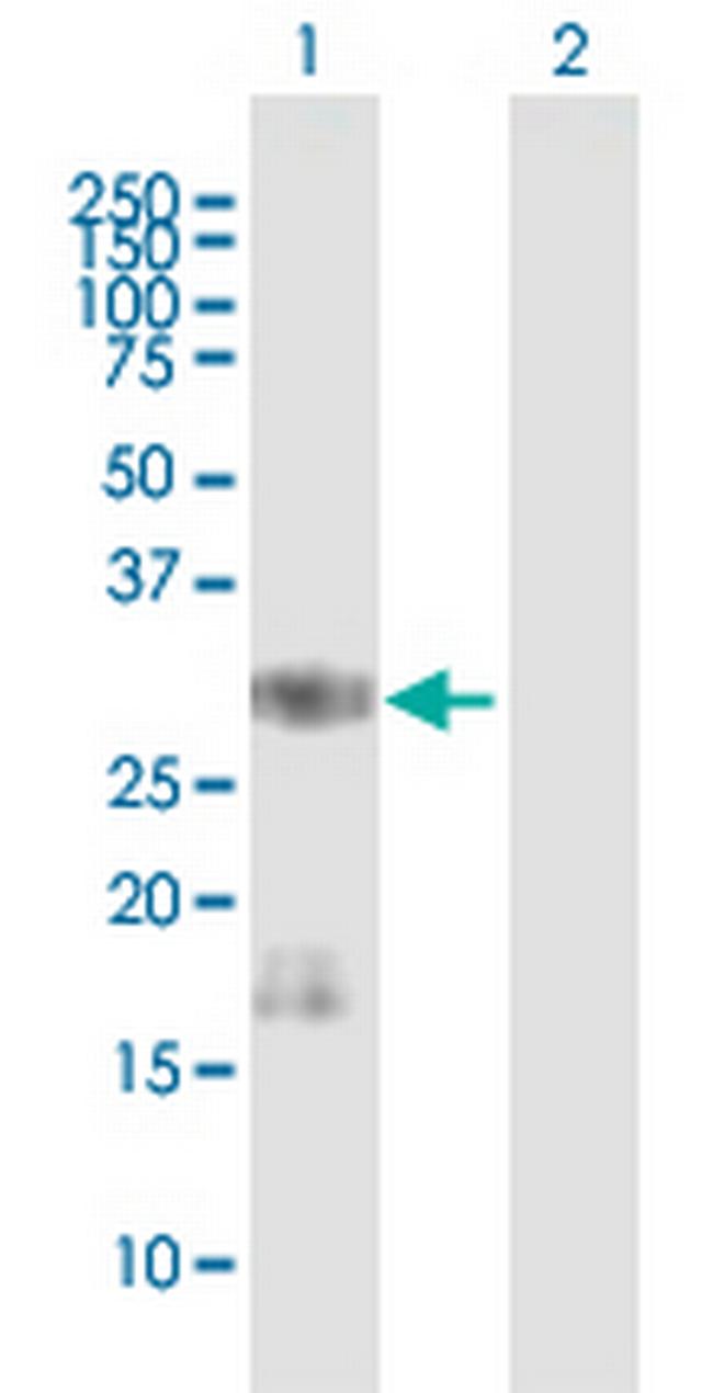 SNAI1 Antibody in Western Blot (WB)