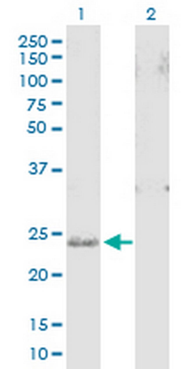 SNAP25 Antibody in Western Blot (WB)