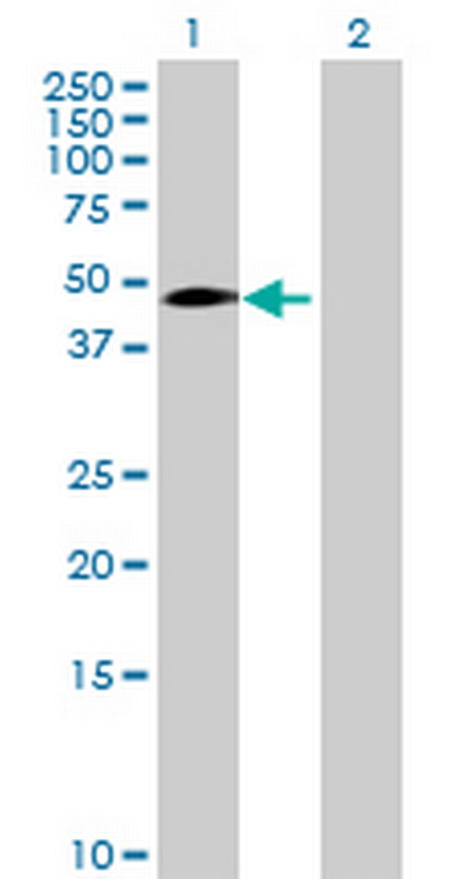 SNAPC2 Antibody in Western Blot (WB)
